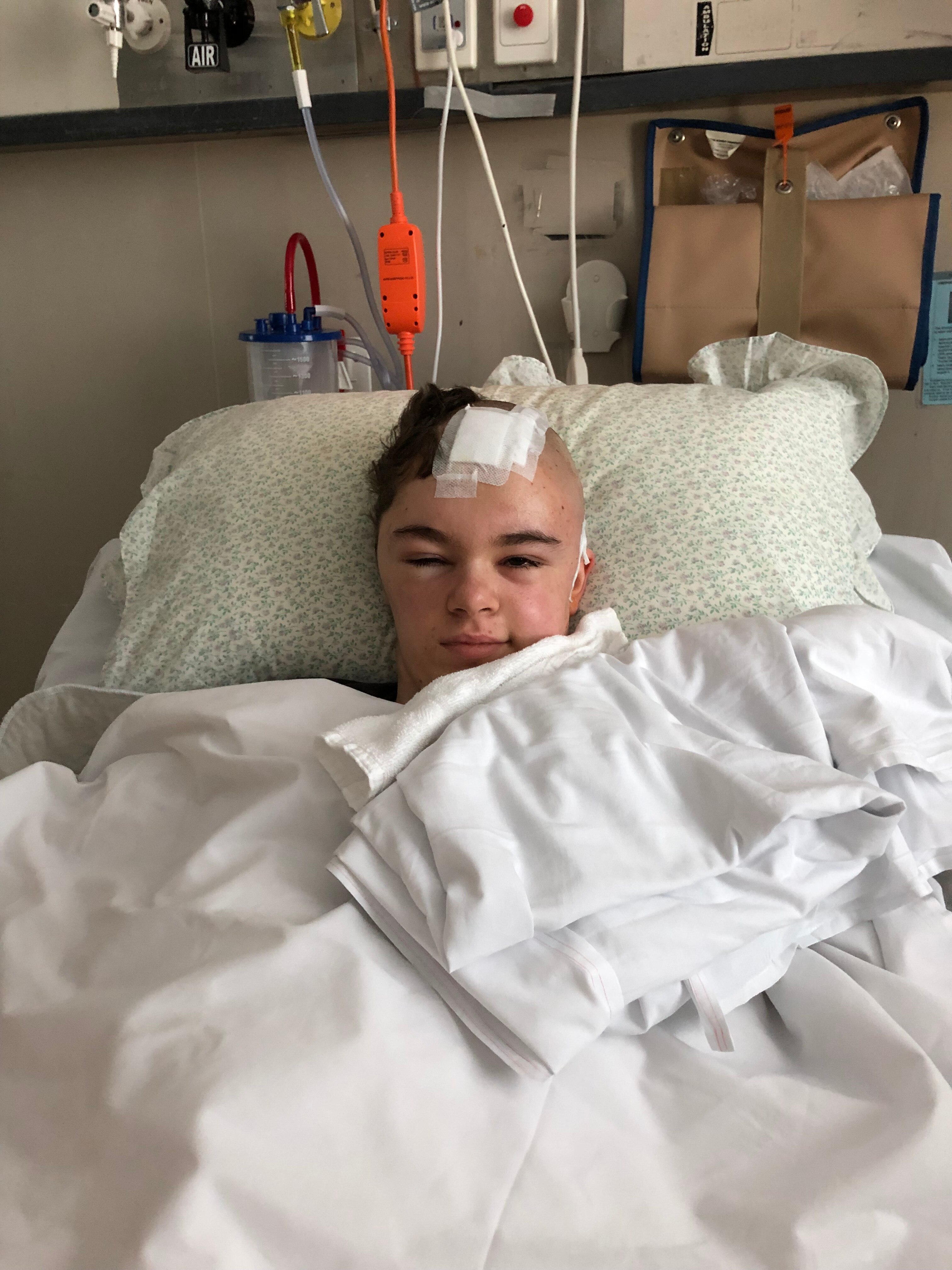 Nicola Bray lies in a hospital bed with half her hair shaved off