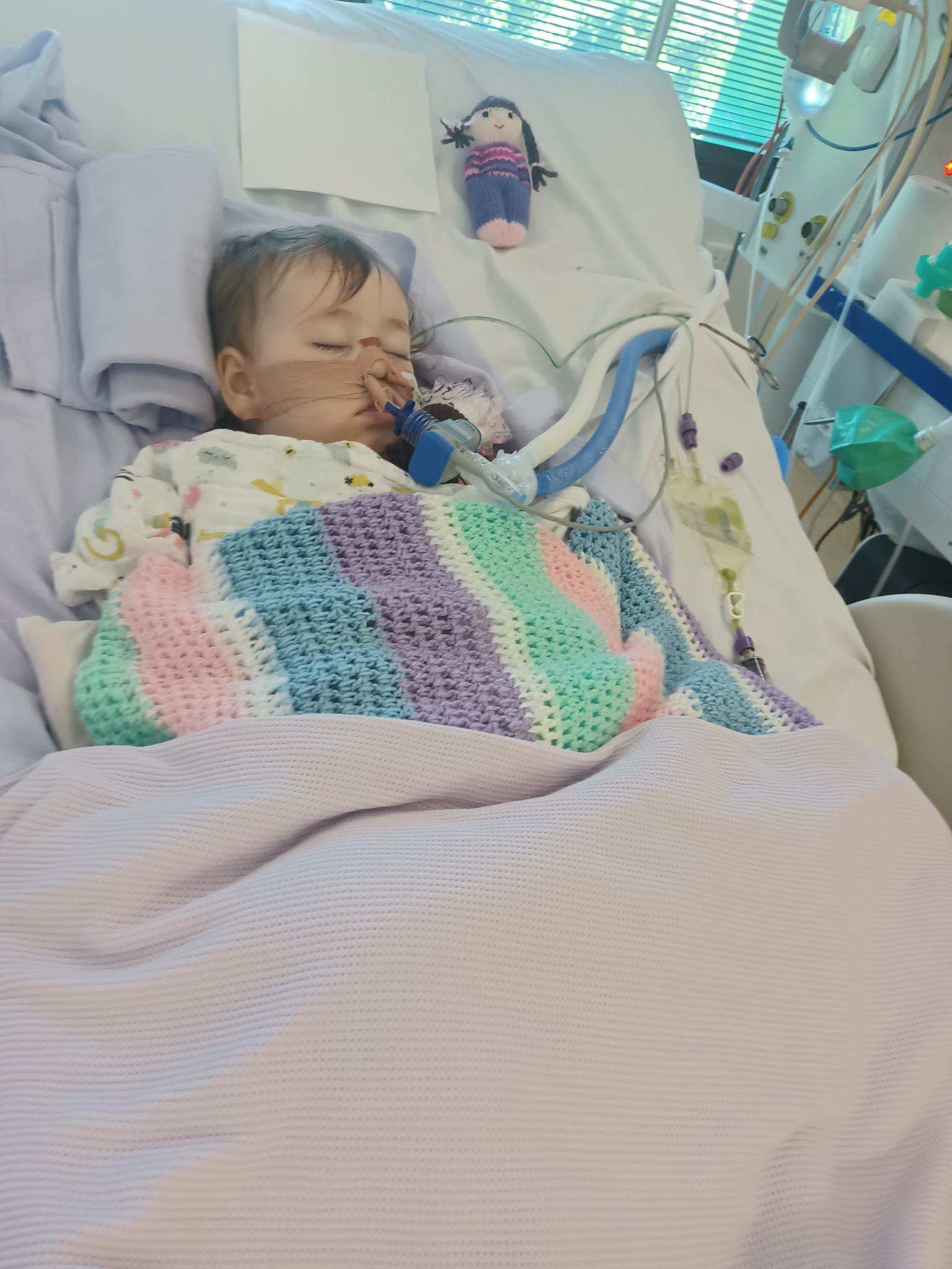 A baby lies unconscious in a hospital bed with tubes up her nose