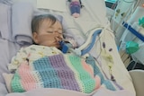 A baby lies unconscious in a hospital bed with tubes up her nose