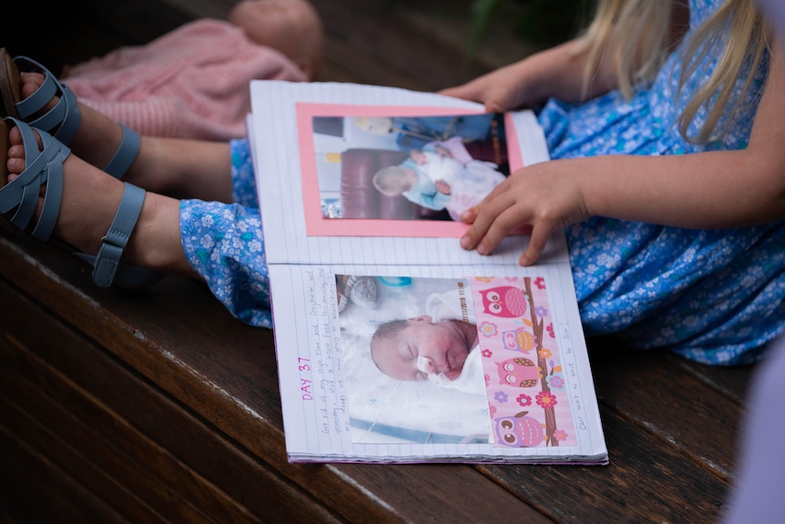 A book of baby photos sits open in the legs on a young girl