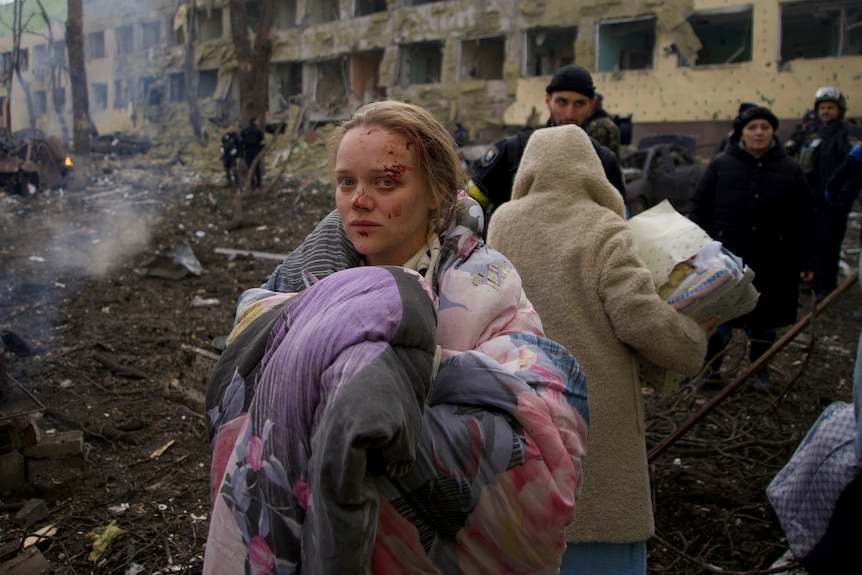 A photo of a woman clutching blankets with cuts on her face