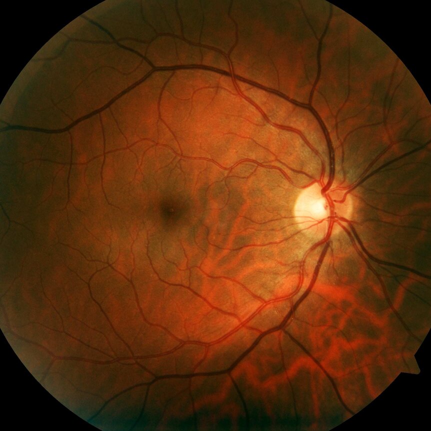 Retinal photograph of human eye, taken using professional clinical diagnostic equipment