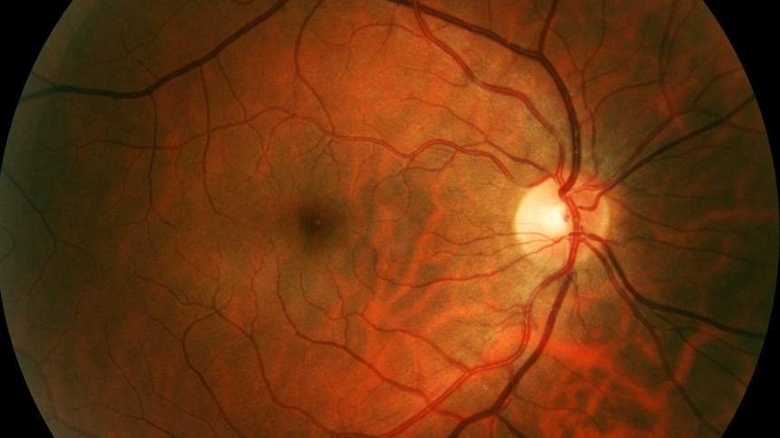 Retinal photograph of human eye, taken using professional clinical diagnostic equipment