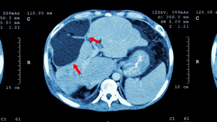 A completely digital computed tomography scan