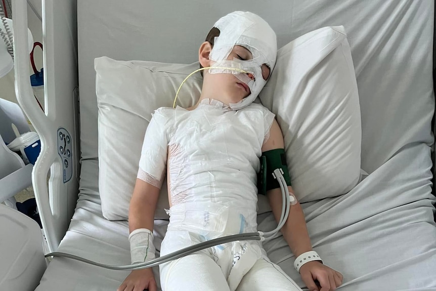 A boy lying in a hospital bed covered in bandages