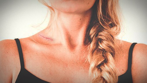 Unidentified woman with scar on neck.