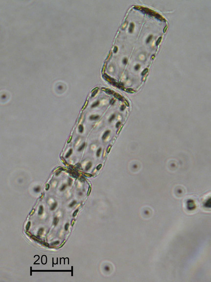 Side view of a centric diatom chain
