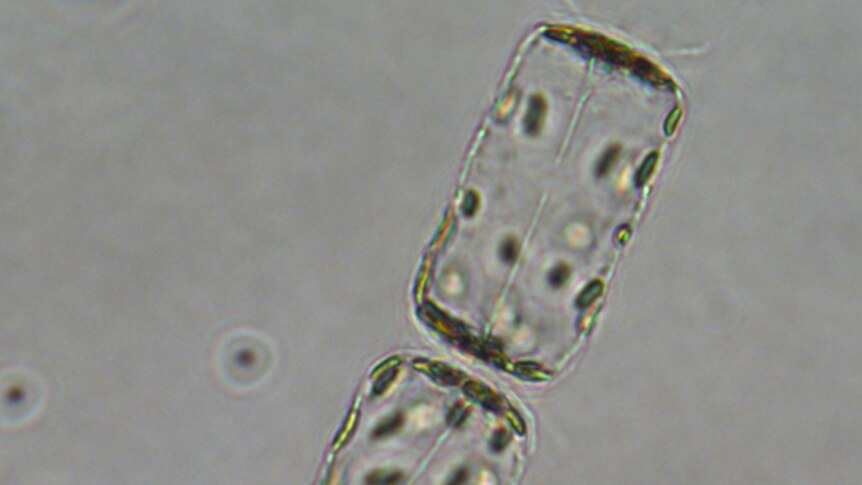 Side view of a centric diatom chain
