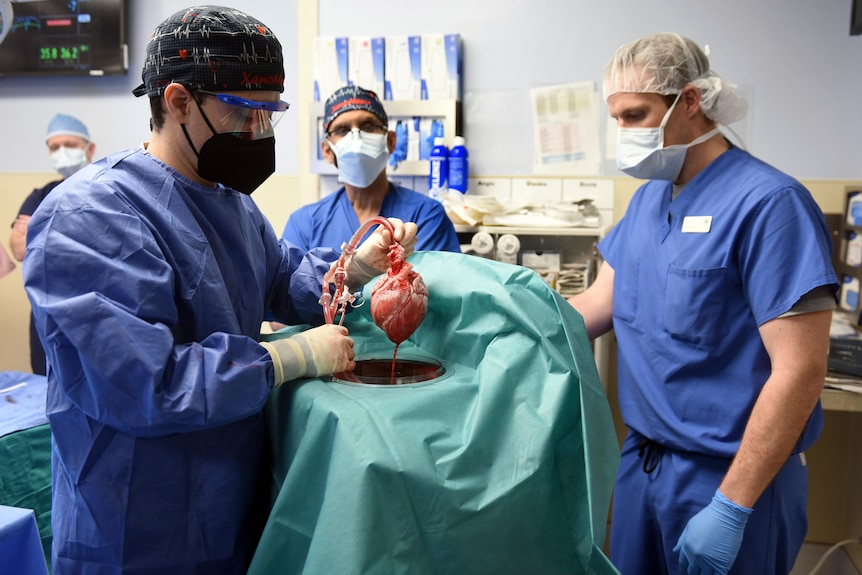 A surgeon holds up a heart attached to tubes in an operating theatre. 