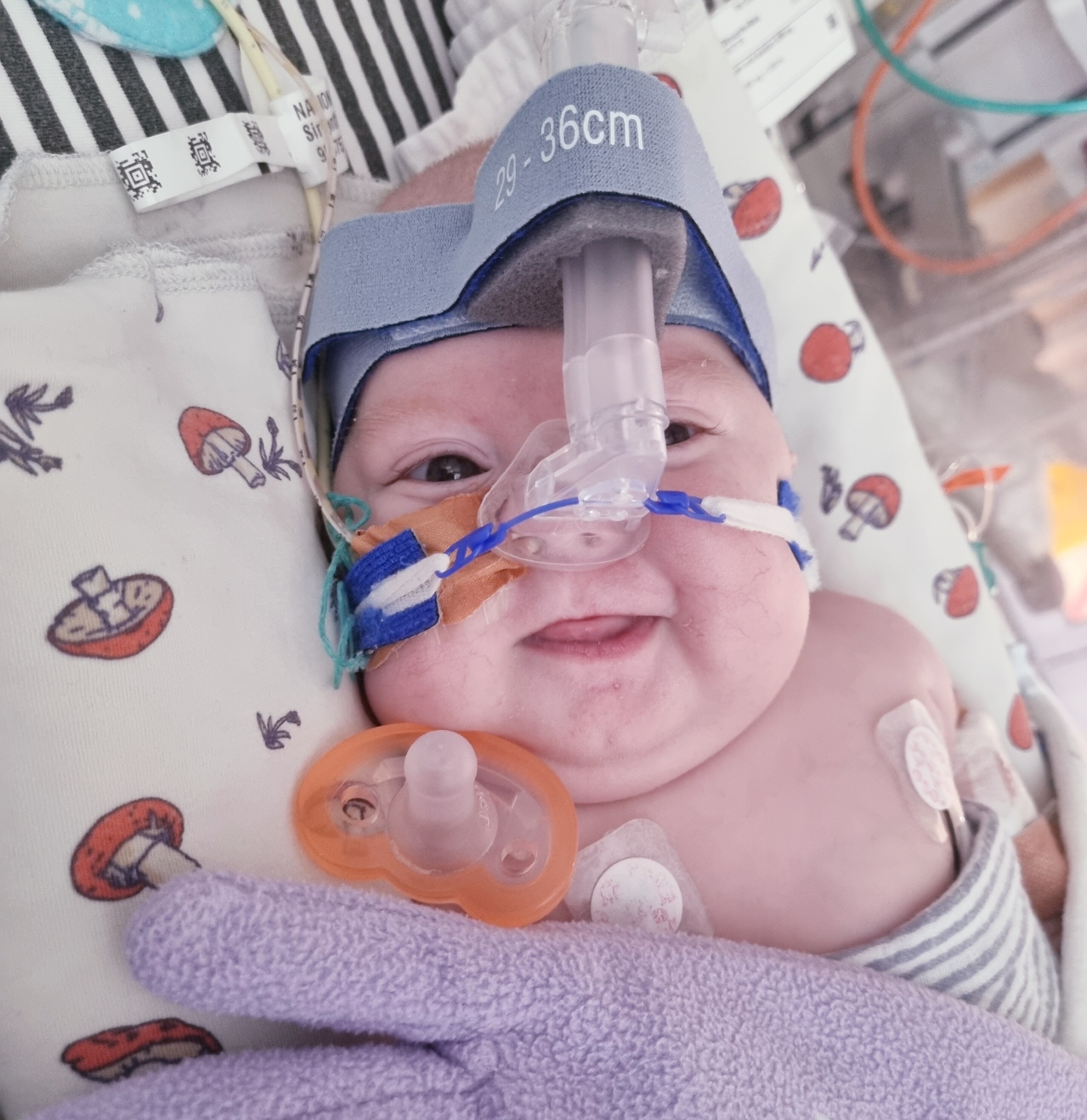 Baby Atticus pictured smiling in hospital, with tubes connected to his nose