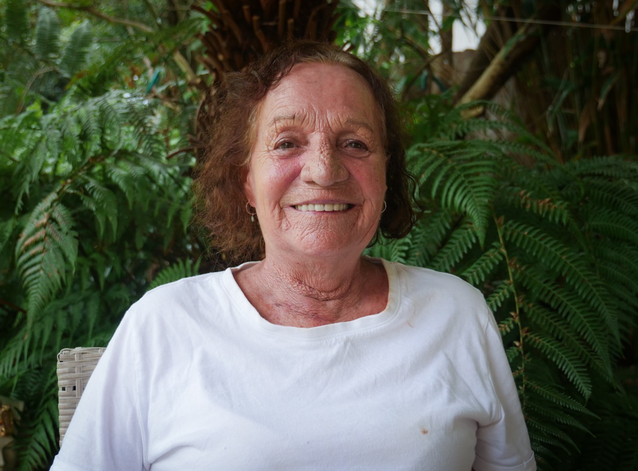 A cropped pic of a lady in a while tshirt with garden greenery in the background.