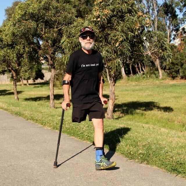 A man with one leg and crutches is walking along a footpath, he's wearing a dark t-shirt and shorts, cap and sunglasses
