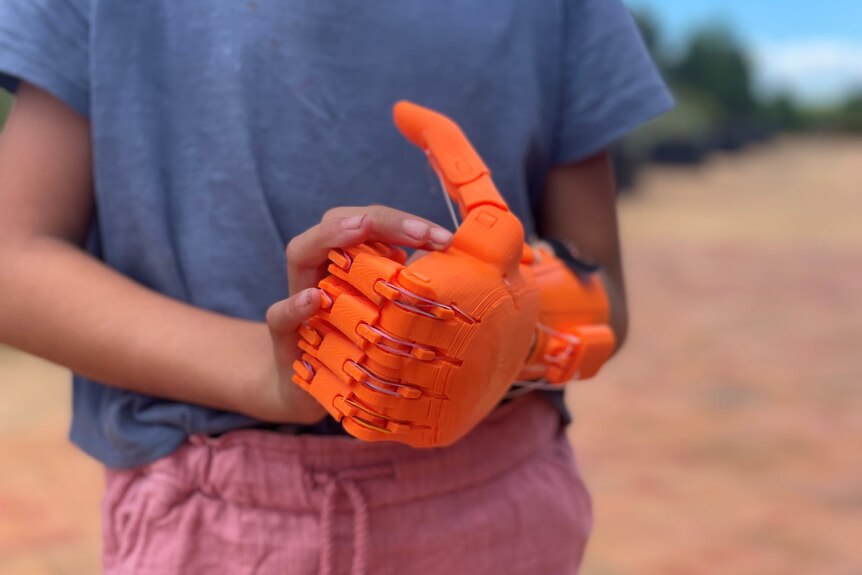 A bring orange prosthetic hand on a young girl 