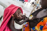 A mother and a severely malnourished child in South Sudan