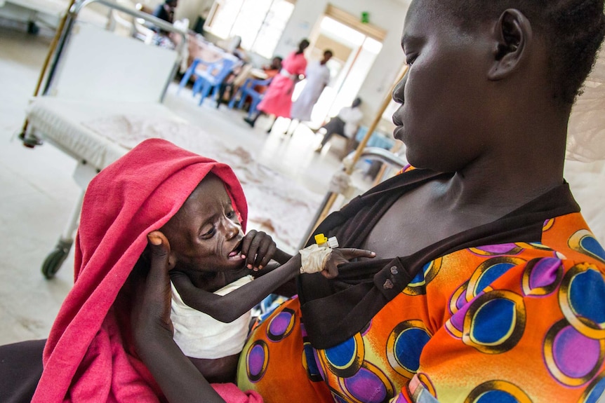 A mother and a severely malnourished child in South Sudan