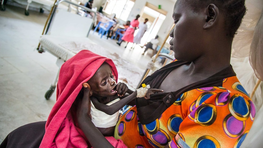 A mother and a severely malnourished child in South Sudan