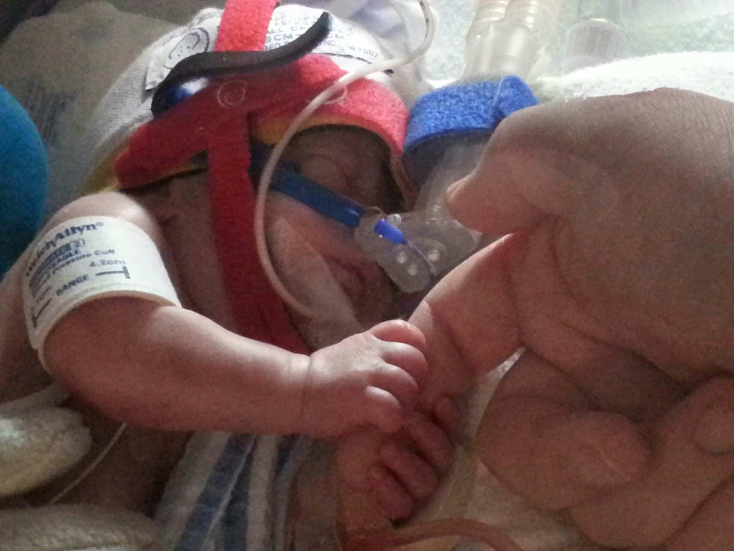 Baby Eli Born Weighing 485 Grams Beats The Odds And Heads Home Abc News