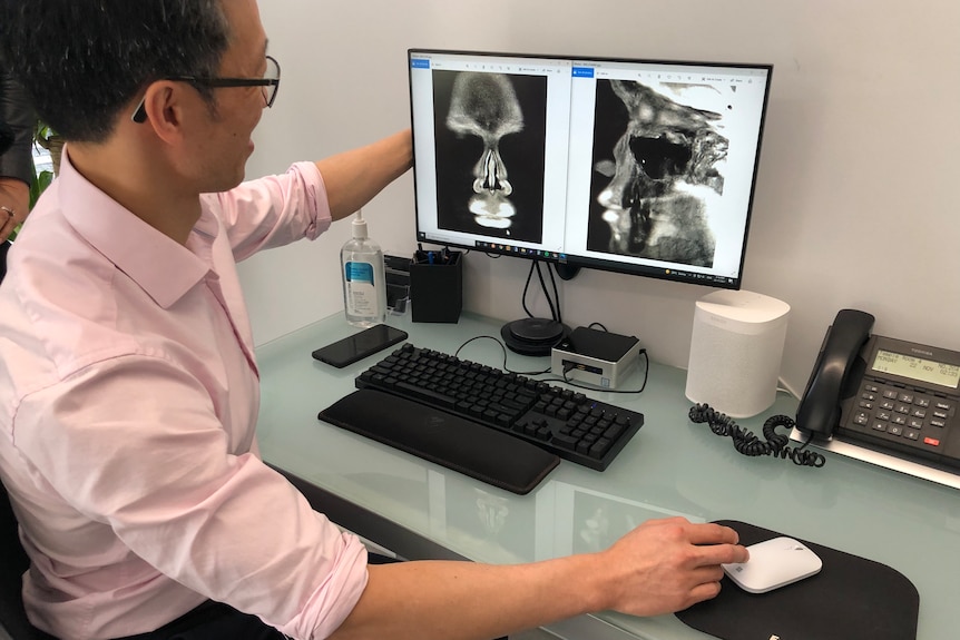 Doctor sitting in front of a MRI scan of someone's face