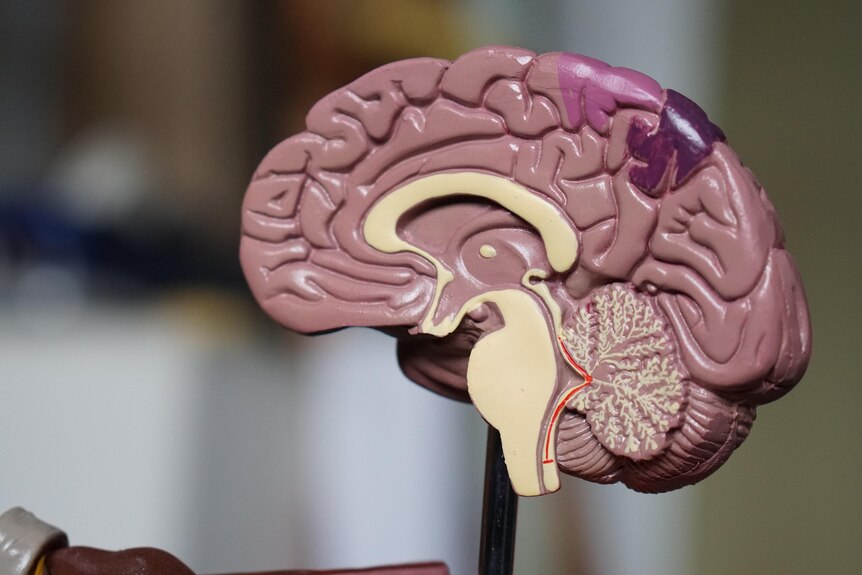 A anatomical model of a brain