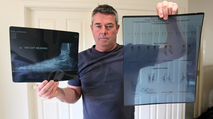John Irvine holds up x-ray and body scan images.