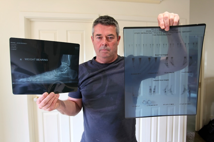 John Irvine holds up x-ray and body scan images.