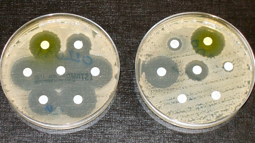 Two petri dishes of bacteria sit side by side