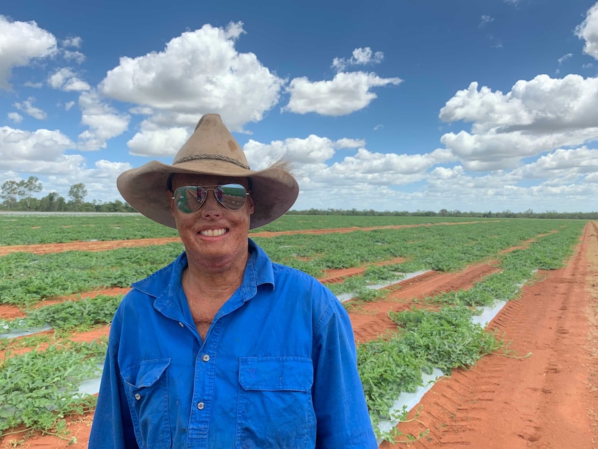 melon farmer in field