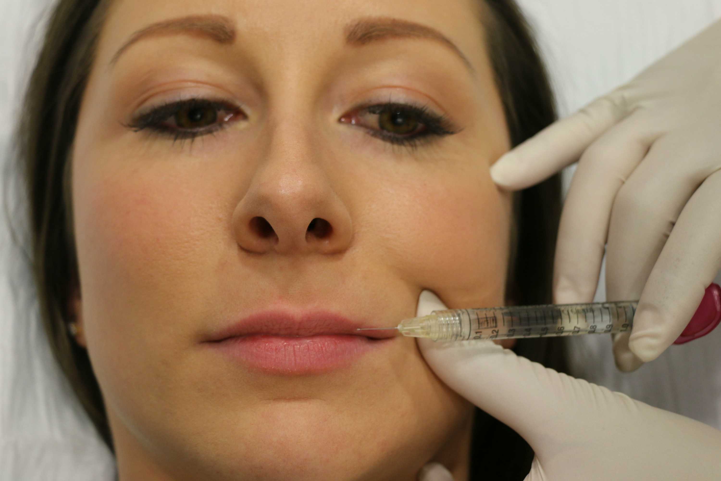 Can Botox Lips Be Reversed