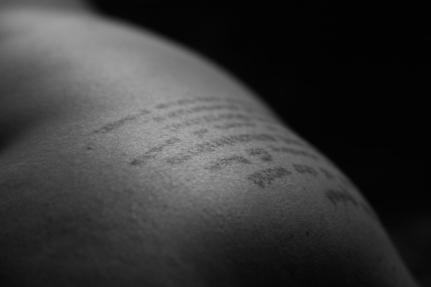 A black and white photograph of skin tattooed with lines of script