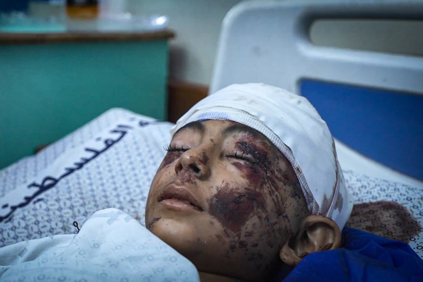 A child with a bandage wrapped around his head lies on a hospital bed