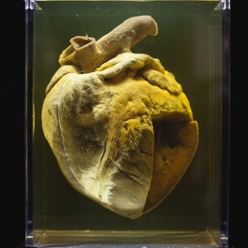 Phar Lap's heart at the National Museum of Australia
