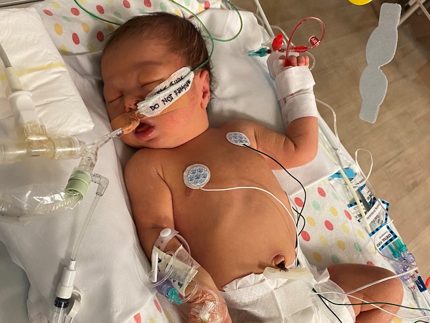 A sleeping baby in intensive care