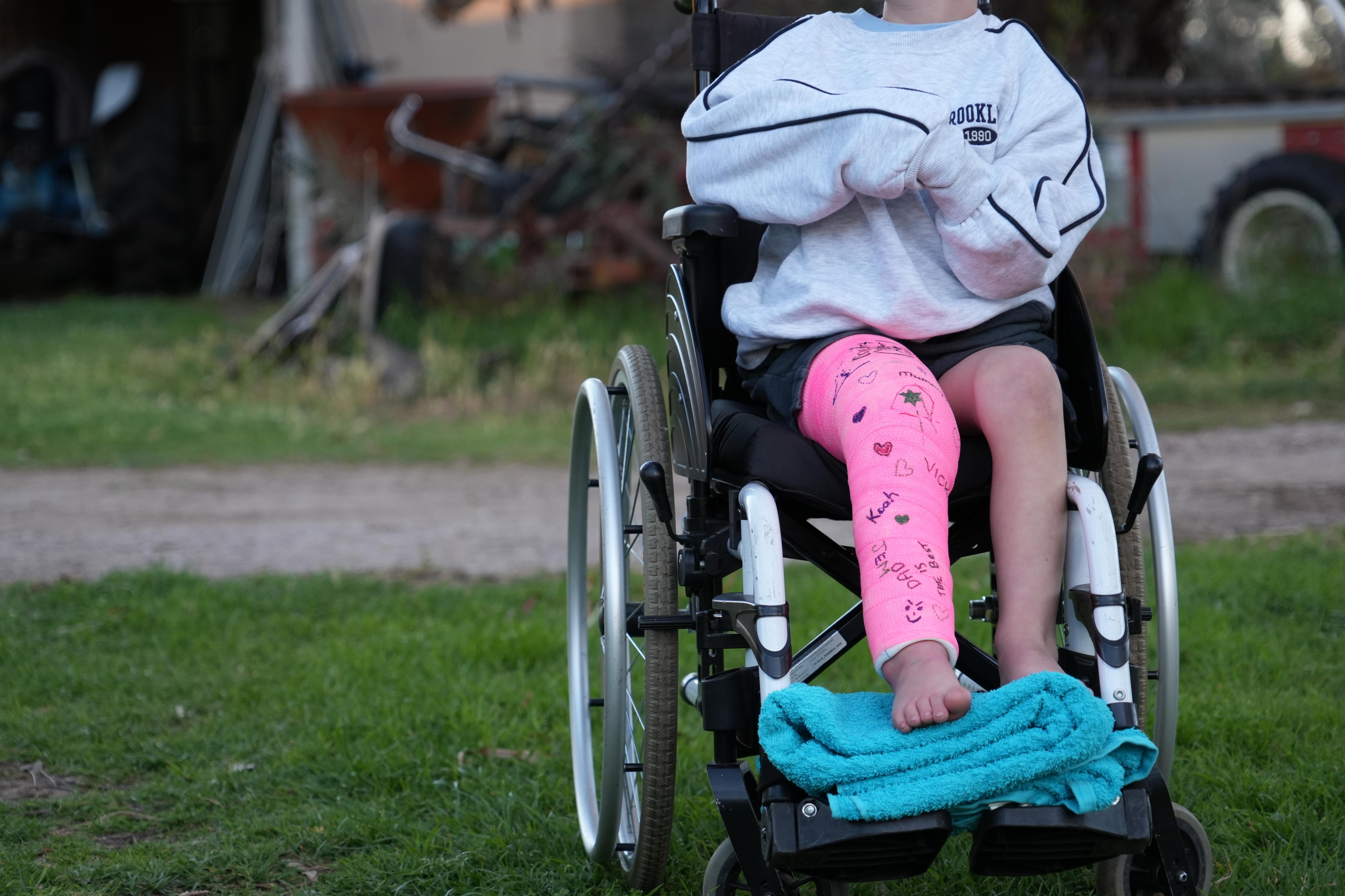 Father's trust in childcare shattered by child's shocking injury