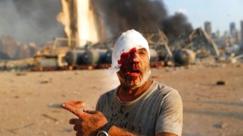 An injured man walks at the explosion scene that hit the seaport, in Beirut Lebanon.