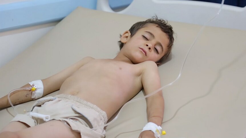 A young boy lies in a hospital bed with his eyes closed.