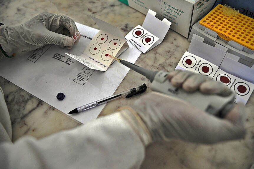 A gloved hand tests malaria samples at a desk