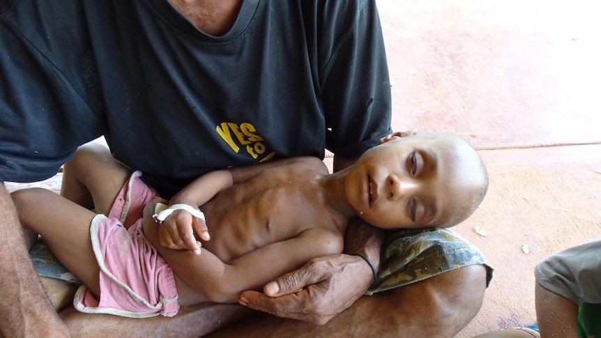 Sick child in Mougulu