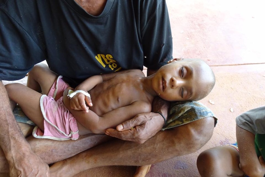 Sick child in Mougulu