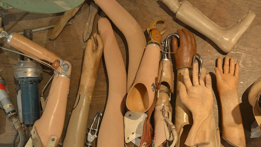 Prosthetic limbs and other manufactured body parts at the COPE visitors' centre.