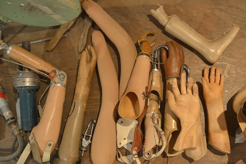 Prosthetic limbs and other manufactured body parts at the COPE visitors' centre.