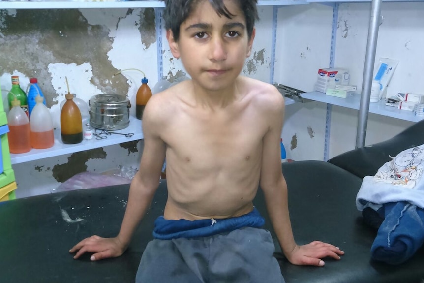 Underweight boy at a Madaya hospital