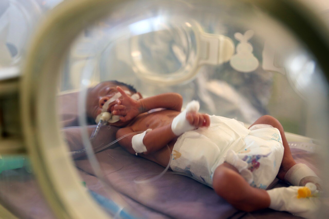 A malnourished young child in an incubator