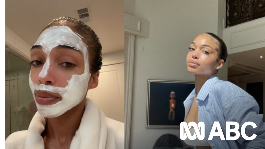 Can applying yoghurt on your face reduce hyperpigmentation? We asked a ...