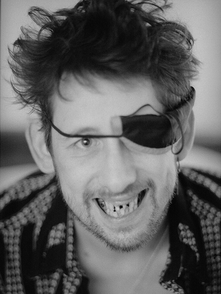 Shane MacGowan wears an eyepatch and smiles at the camera, revealing his crooked teeth