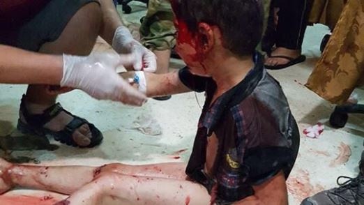 An injured, bloodied child sits on the floor of a hospital.