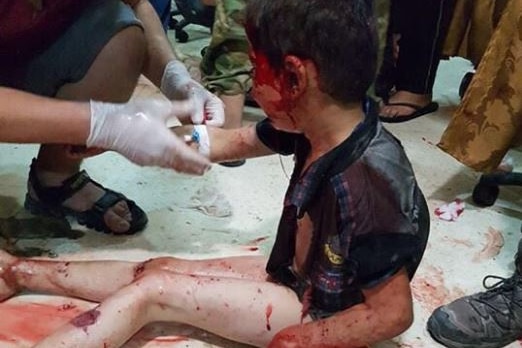 An injured, bloodied child sits on the floor of a hospital.