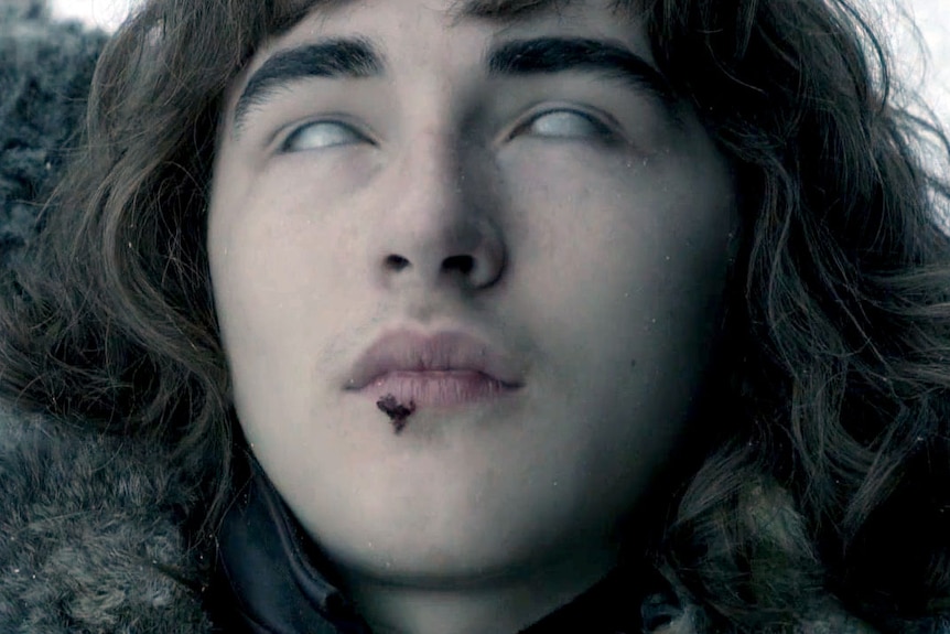 Bran Stark rolls his eyes back, showing only white, as he has a trance.