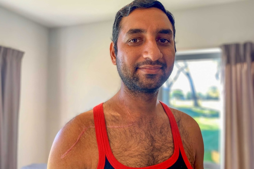 A man wearing a singlet with a huge scar running from his neck down his arm