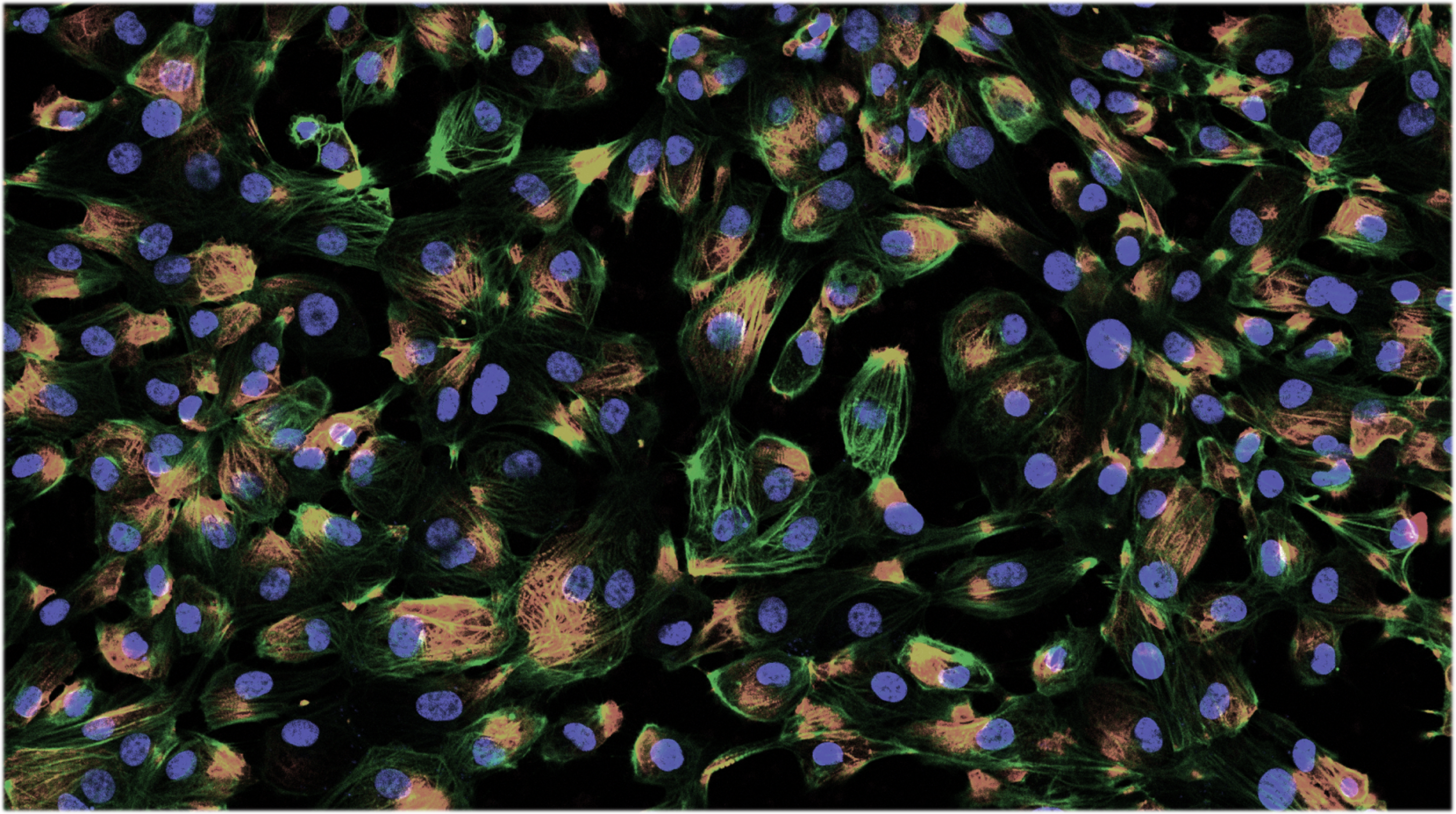 Knee arthritis and stem cells | Alzheimer's and women | spider venom and hearts | Maturity-onset diabetes and genetic testing