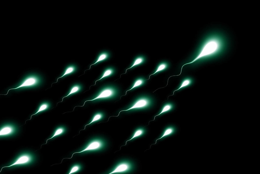 An illustration of sperm